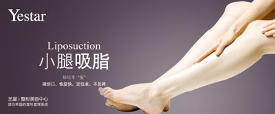 小腿可以吸脂减肥吗