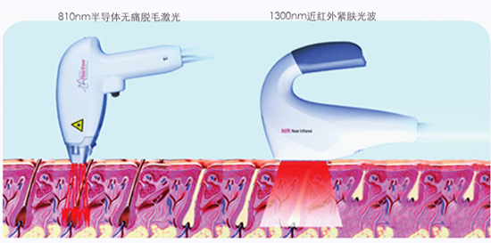 冰点脱毛原理图