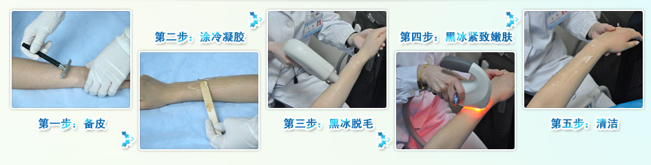 脱毛步骤图