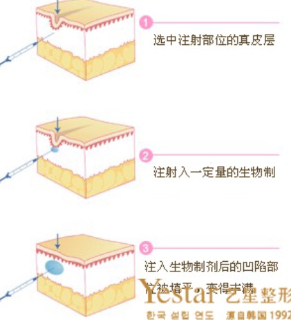 丰面颊原理图