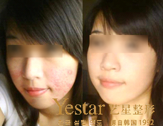 治疗效果