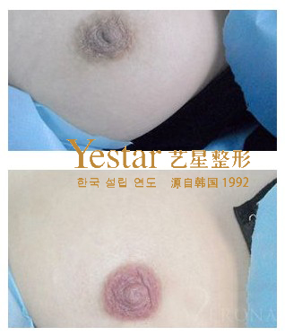 艺星漂红效果图