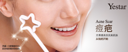 激光祛痘不留痕