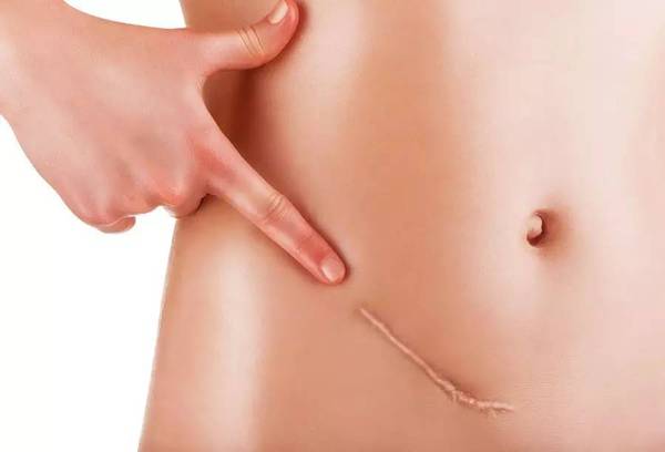 上海哪家医院去疤痕效果好