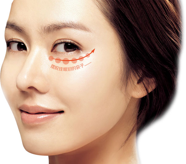 上海做眼部吸脂要注意什么