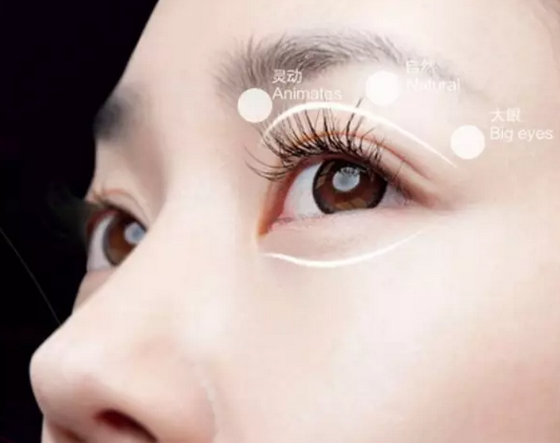 上海眼部吸脂的费用多少