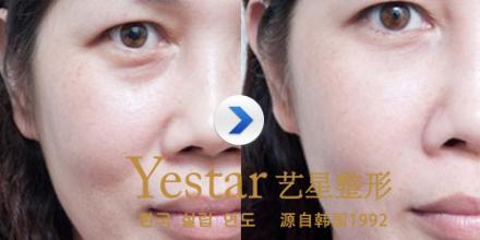 上海艺星整形医院