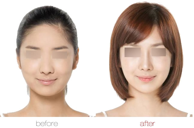 上海艺星丰下巴