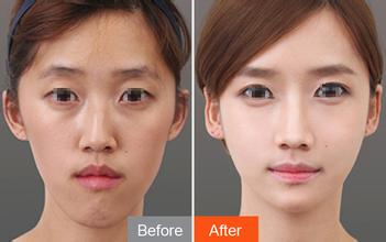 上海艺星整形医院