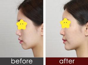 上海艺星整形医院