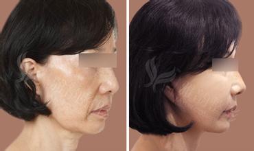 上海艺星整形医院