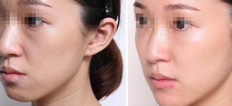 上海艺星整形医院