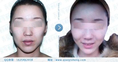 上海艺星整形医院