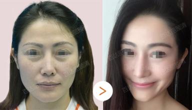 上海艺星整形医院