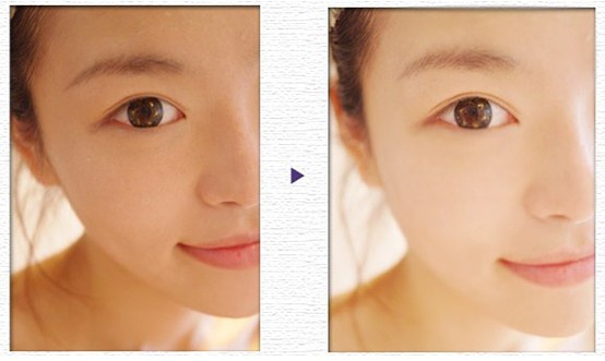 毛孔粗大黑头多怎么办