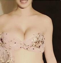 自体脂肪丰胸适合产后妈妈吗