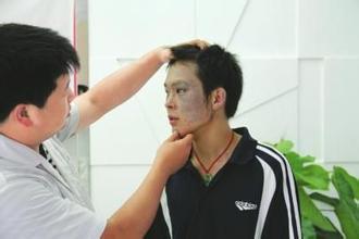 太田痣用什么方法祛掉