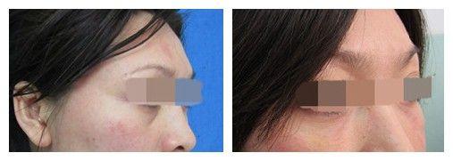 上海艺星整形医院