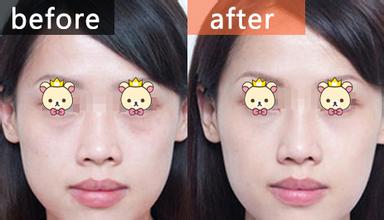 上海艺星整形医院