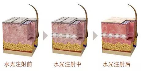 影响水光效果的4大因素