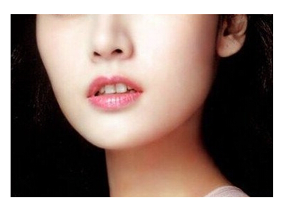 上海脱唇毛哪里好