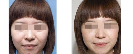 上海艺星整形医院