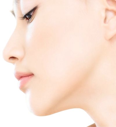 下巴整形手术要注意什么