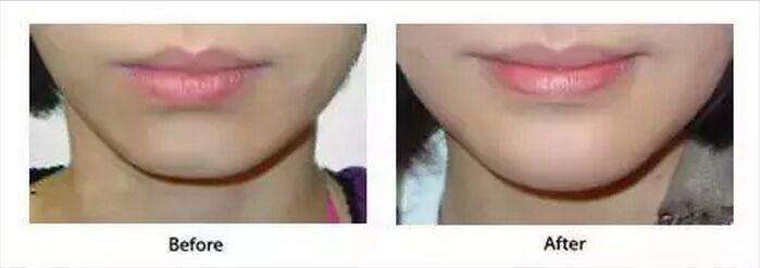 下巴整形哪里做的好