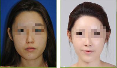 下巴整形哪里做的好