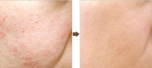 上海艺星整形医院