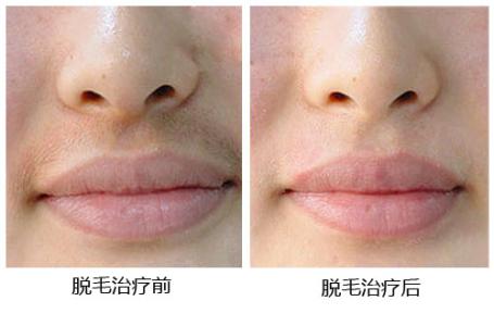 上海艺星整形医院