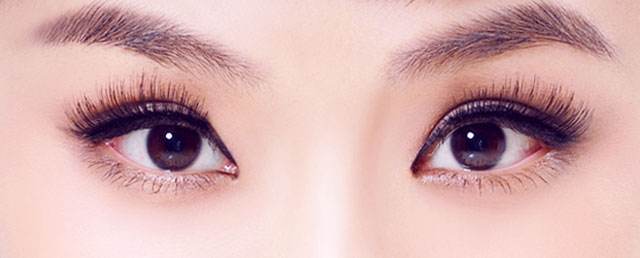 上海双眼皮手术修复方法有哪些