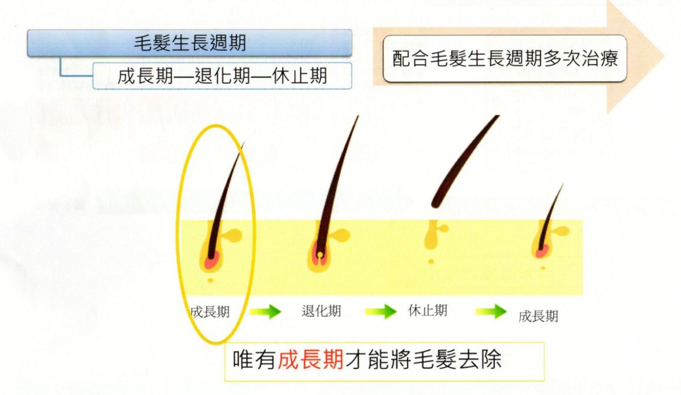 脱毛