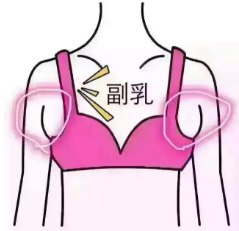 副乳