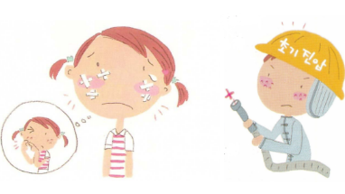 激光去痘印多少钱