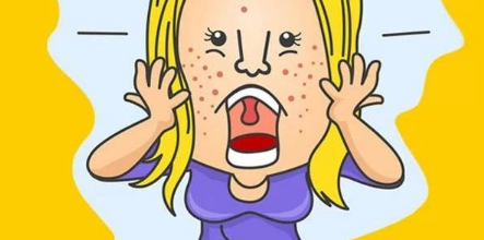 美容医院可以祛除痘印吗