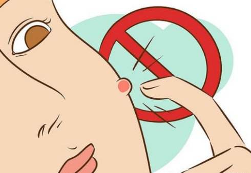 哪个方法能去痘印的