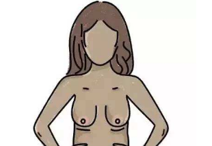 隆胸可以矫正乳房下垂吗