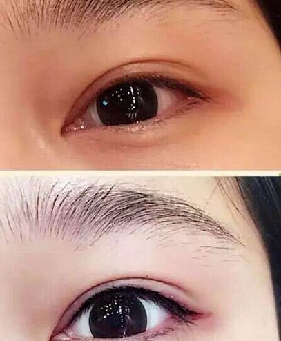 纹眼线痛不痛呢