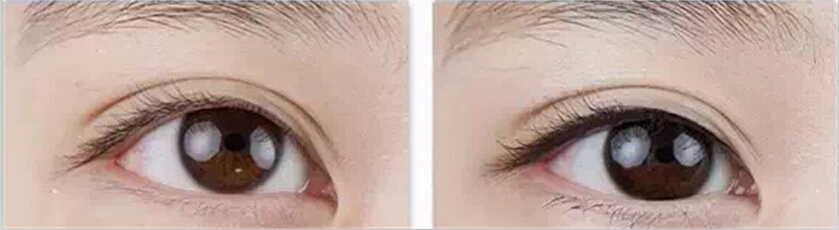 纹眼线是怎么样纹的