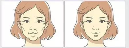 做水光嫩肤是安全的吗