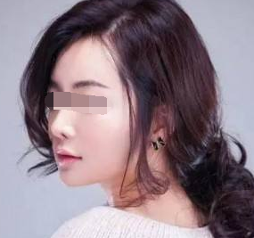 做水光嫩肤是安全的吗