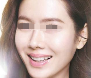 做水光嫩肤是安全的吗