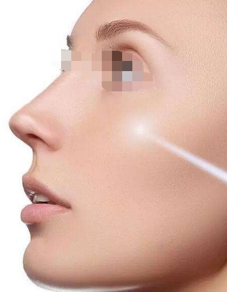 在水光术后多久可以洗脸