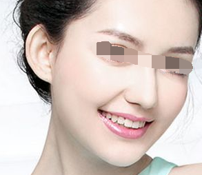 在水光术后多久可以洗脸