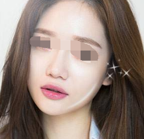 在水光术后多久可以洗脸