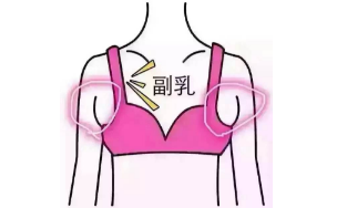 副乳