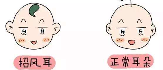 招风耳矫正术价格是多少