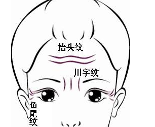 上海去除额头纹的有效方法