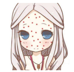 激光祛痘印费用贵不贵